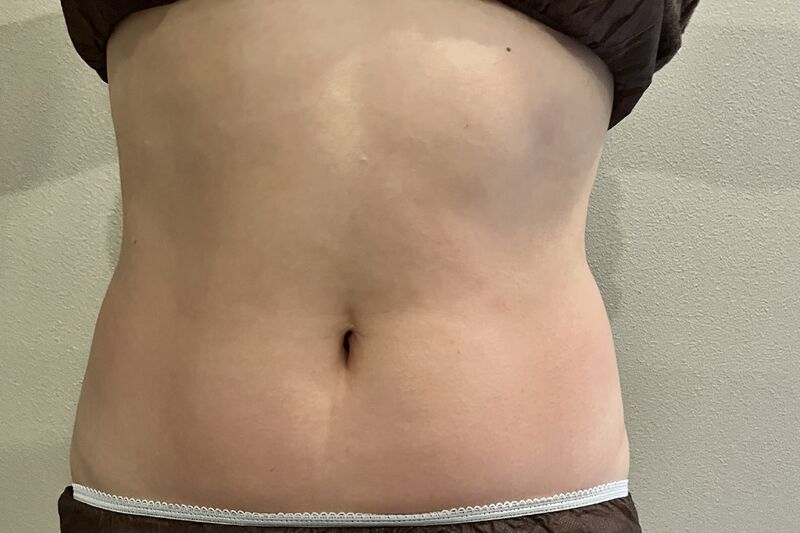 石井様腹A