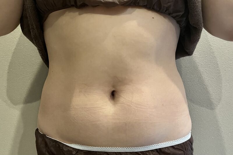 石井様腹B